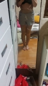 Abdomen + Thigh Liposuction — Korea cost, reviews & before-after | MISOODA