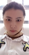 facial contouring.. 2 — Korea cost, reviews & before-after | MISOODA