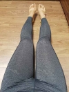 Thighs liposuction 2 — Korea cost, reviews & before-after | MISOODA