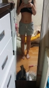 Abdomen + Thigh Liposuction — Korea cost, reviews & before-after | MISOODA