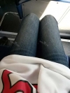 Thighs liposuction 1 — Korea cost, reviews & before-after | MISOODA