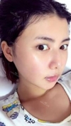 facial contouring.. 2 — Korea cost, reviews & before-after | MISOODA