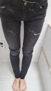 Thighs liposuction — Korea cost, reviews & before-after | MISOODA