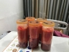 Liposcution surgery — Korea cost, reviews & before-after | MISOODA