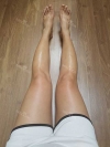 Thighs liposuction 2 — Korea cost, reviews & before-after | MISOODA