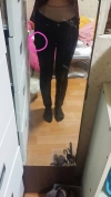 Abdomen + Thigh Liposuction — Korea cost, reviews & before-after | MISOODA