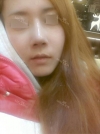 Rhinoplasty~! — Korea cost, reviews & before-after | MISOODA