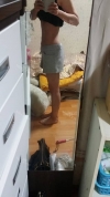 Abdomen + Thigh Liposuction — Korea cost, reviews & before-after | MISOODA