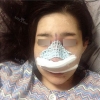 Nose Revision... — Korea cost, reviews & before-after | MISOODA