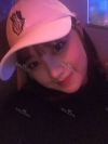 Nose job for confidence! — Korea cost, reviews & before-after | MISOODA