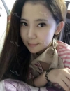 Facial contouring 1 — Korea cost, reviews & before-after | MISOODA