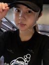 Facial contouring 1 — Korea cost, reviews & before-after | MISOODA