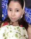 Facial contouring 1 — Korea cost, reviews & before-after | MISOODA