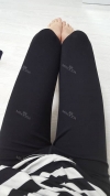 Thighs liposuction — Korea cost, reviews & before-after | MISOODA