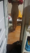 Abdomen + Thigh Liposuction — Korea cost, reviews & before-after | MISOODA