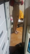 Abdomen + Thigh Liposuction — Korea cost, reviews & before-after | MISOODA