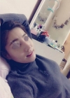 Nose Revision... — Korea cost, reviews & before-after | MISOODA