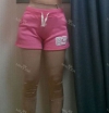 Thighs liposuction 1 — Korea cost, reviews & before-after | MISOODA