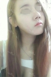 Rhinoplasty~! — Korea cost, reviews & before-after | MISOODA