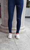 Thighs liposuction — Korea cost, reviews & before-after | MISOODA
