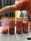Liposcution surgery — Korea cost, reviews & before-after | MISOODA