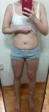 30 years old get your self confidence with a sexy body! — Korea cost, reviews & before-after | MISOODA