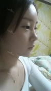 Face Liposuction — Korea cost, reviews & before-after | MISOODA
