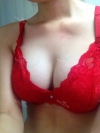 Breast agumentation — Korea cost, reviews & before-after | MISOODA