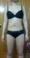 30 years old get your self confidence with a sexy body! — Korea cost, reviews & before-after | MISOODA