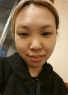 I became younger!! — Korea cost, reviews & before-after | MISOODA