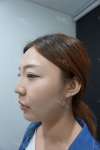 MISOODA — Korea cost, reviews & before-after | MISOODA