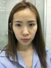 Jaw Reduction, Rhinoplasty and Breast Augmentation in Korea — Korea cost, reviews & before-after | MISOODA