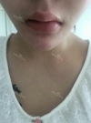 my beautiful lips — Korea cost, reviews & before-after | MISOODA