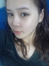 Facial Contouring Surgery+Square Jaw Reduction,+Chin Reduction,+Zygoma Reduction+Full face fat graft — Korea cost, reviews & before-after | MISOODA