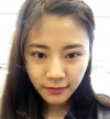 Square jaw reduction + Double eyelid revision surgery — Korea cost, reviews & before-after | MISOODA