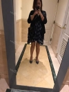 Liposcution surgery — Korea cost, reviews & before-after | MISOODA