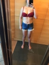Liposcution surgery — Korea cost, reviews & before-after | MISOODA