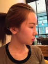 Jaw Reduction, Rhinoplasty and Breast Augmentation in Korea — Korea cost, reviews & before-after | MISOODA