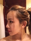 Jaw Reduction, Rhinoplasty and Breast Augmentation in Korea — Korea cost, reviews & before-after | MISOODA