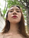 Jaw Reduction, Rhinoplasty and Breast Augmentation in Korea — Korea cost, reviews & before-after | MISOODA