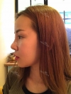 Jaw Reduction, Rhinoplasty and Breast Augmentation in Korea — Korea cost, reviews & before-after | MISOODA