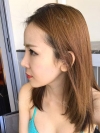 Jaw Reduction, Rhinoplasty and Breast Augmentation in Korea — Korea cost, reviews & before-after | MISOODA