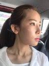 Jaw Reduction, Rhinoplasty and Breast Augmentation in Korea — Korea cost, reviews & before-after | MISOODA