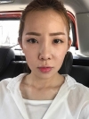 Jaw Reduction, Rhinoplasty and Breast Augmentation in Korea — Korea cost, reviews & before-after | MISOODA