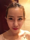 Jaw Reduction, Rhinoplasty and Breast Augmentation in Korea — Korea cost, reviews & before-after | MISOODA