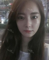 Eye, Nose, Micro Fat Grafting, Facial bone contouring surgery — Korea cost, reviews & before-after | MISOODA