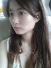 Eye, Nose, Micro Fat Grafting, Facial bone contouring surgery — Korea cost, reviews & before-after | MISOODA