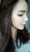 Eye, Nose, Micro Fat Grafting surgery real reviews! — Korea cost, reviews & before-after | MISOODA