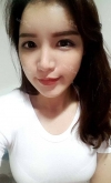 Eye, Nose, Micro Fat Grafting surgery real reviews! — Korea cost, reviews & before-after | MISOODA