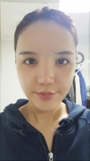 Eye, Nose, Micro Fat Grafting surgery real reviews! — Korea cost, reviews & before-after | MISOODA